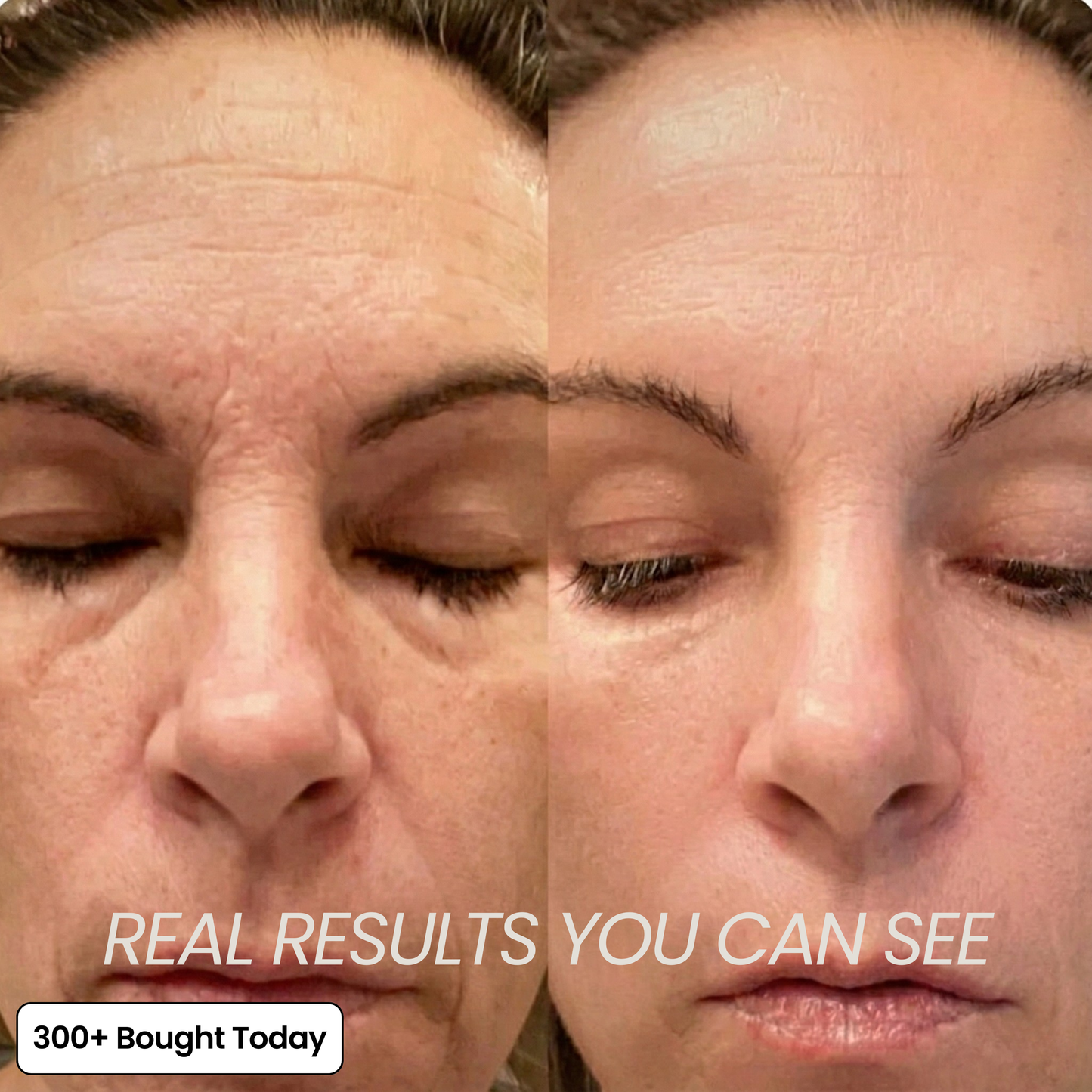 Transform Wrinkles, Fine Lines, And Tired Creases Naturally!