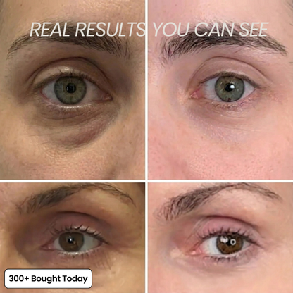 Transform Wrinkles, Fine Lines, And Tired Creases Naturally!
