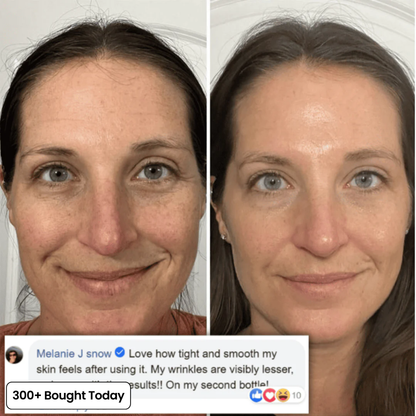 Transform Wrinkles, Fine Lines, And Tired Creases Naturally!