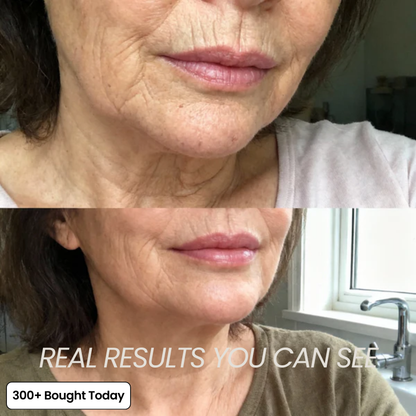 COMPLETE FACE RENEWAL KIT