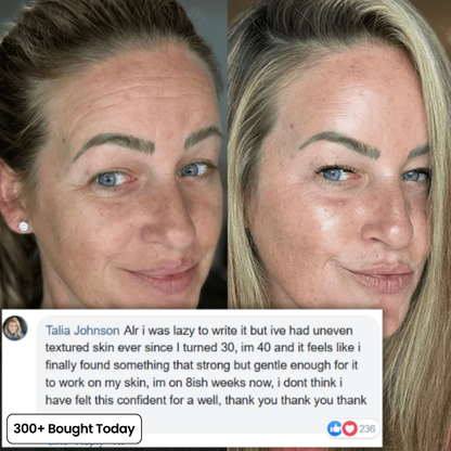 COMPLETE FACE RENEWAL KIT